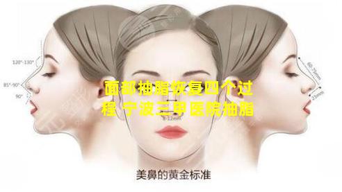面部抽脂恢复四个过程 宁波三甲医院抽脂